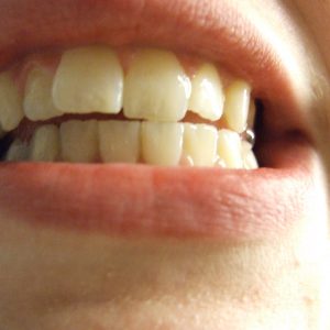 Sarah Stambaugh - teeth